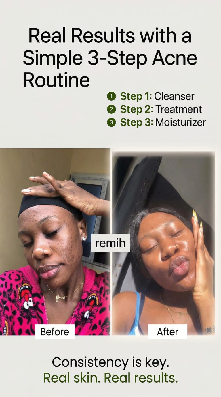 Remih Hormonal Wellness Tea