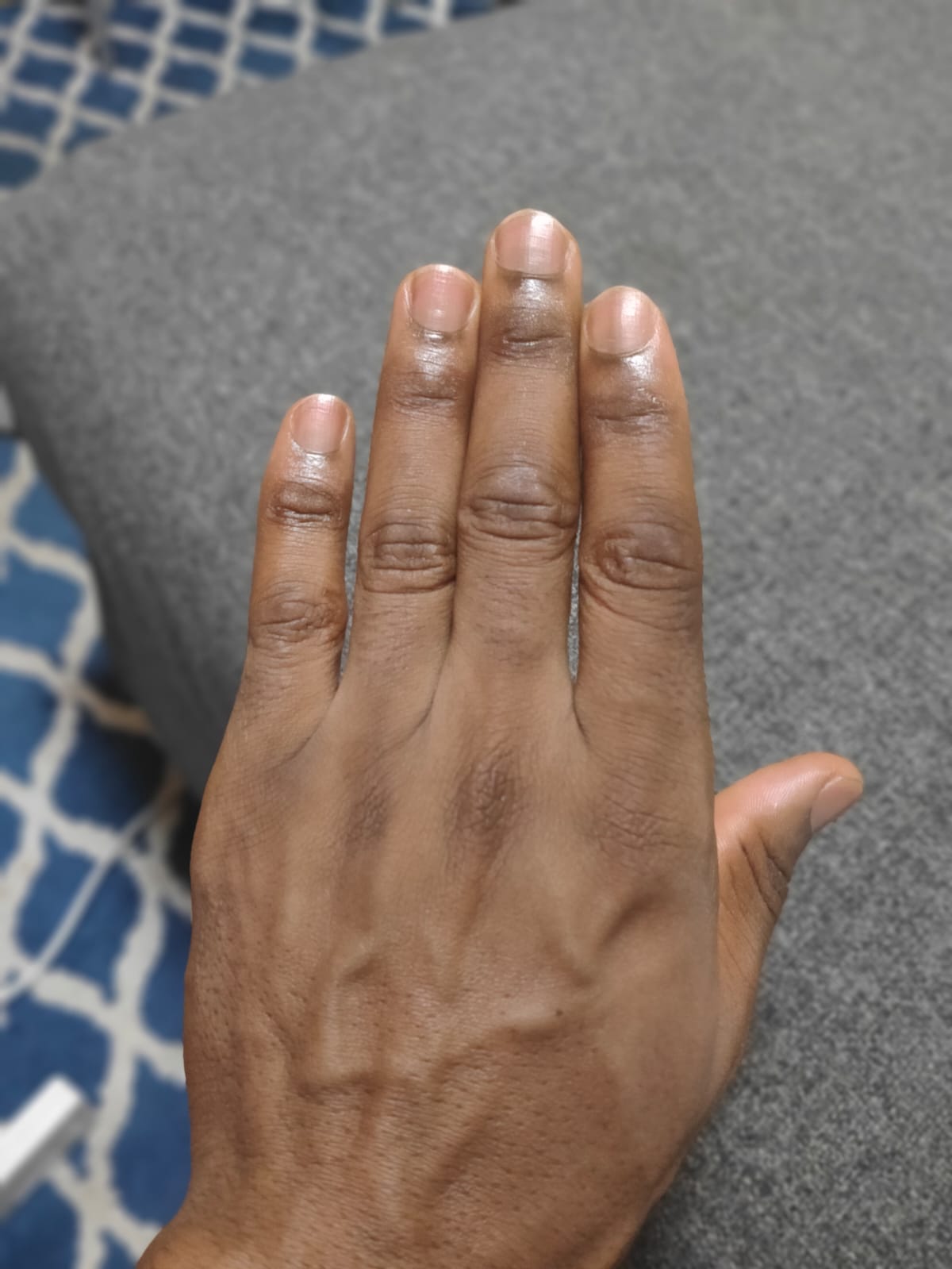 Unlock Radiant Hands: A Comprehensive Guide on How to Clear Dark Knuckles