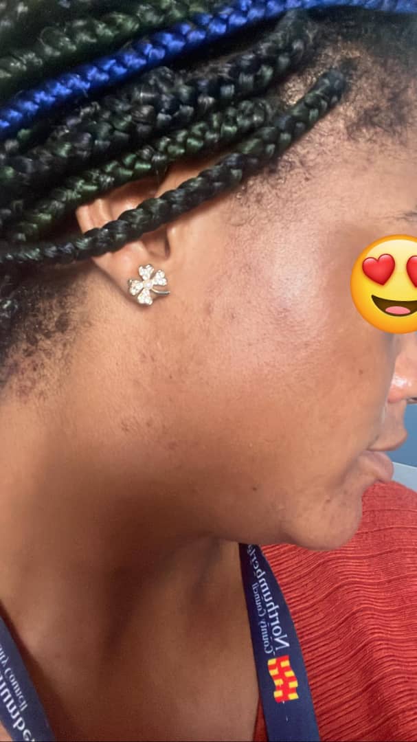 before and after image of a customer