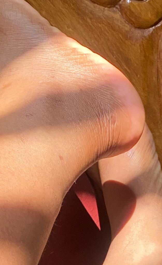 leg brightening before and after image of a customer
