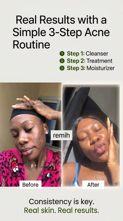 Remih Hormonal Wellness Tea